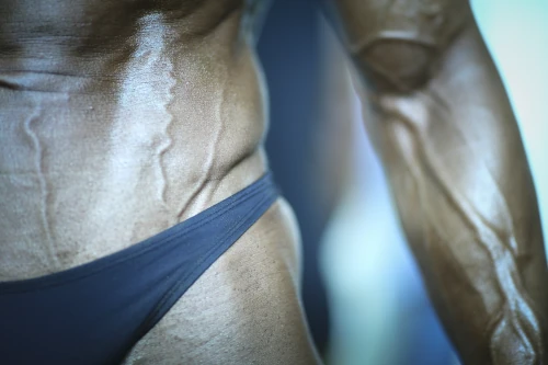 vascularity